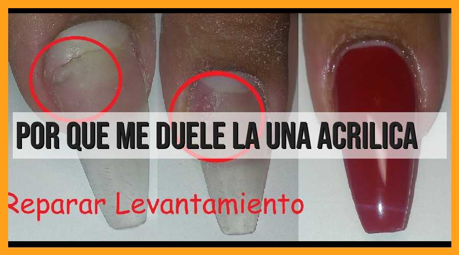 ¿Por qué duelen las uñas acrílicas?
