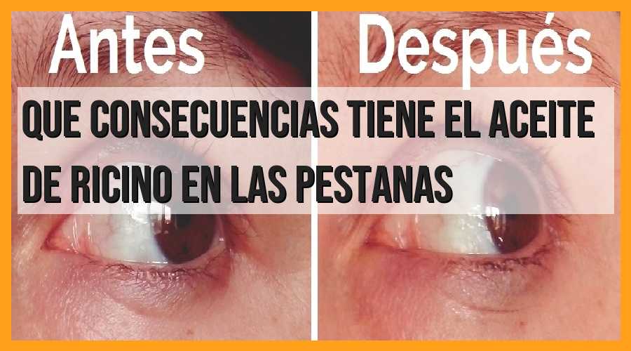 Consecuencias del aceite de ricino en las pestañas