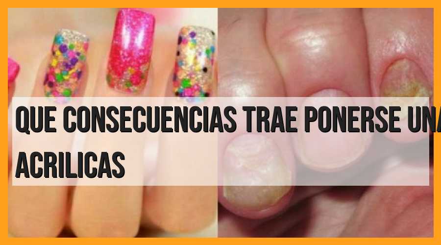 Consecuencias de las uñas acrílicas: todo lo que debes saber