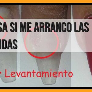 Consecuencias de arrancarse las esculpidas