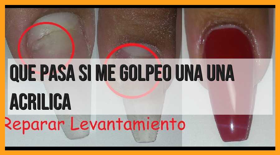 ¿Qué sucede si me golpeo una uña acrílica?