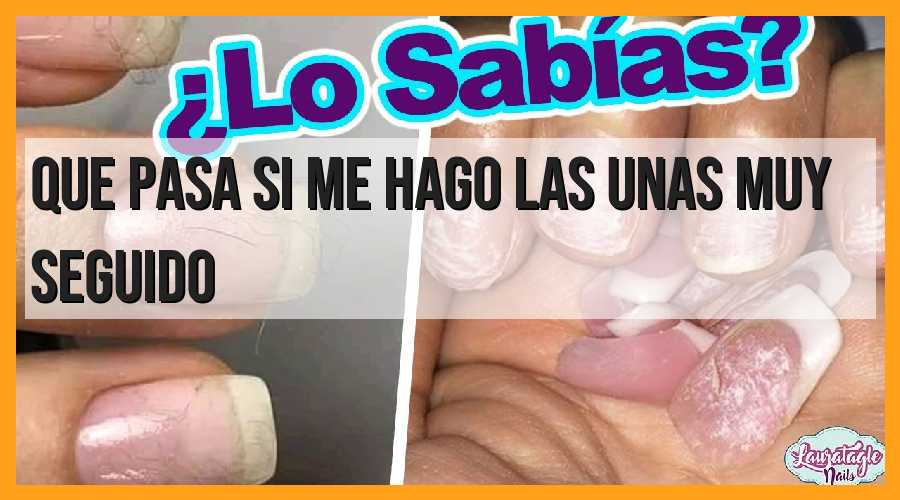Consecuencias de hacerse las uñas muy seguido